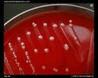 Listeria monocytogenes culture on blood agar